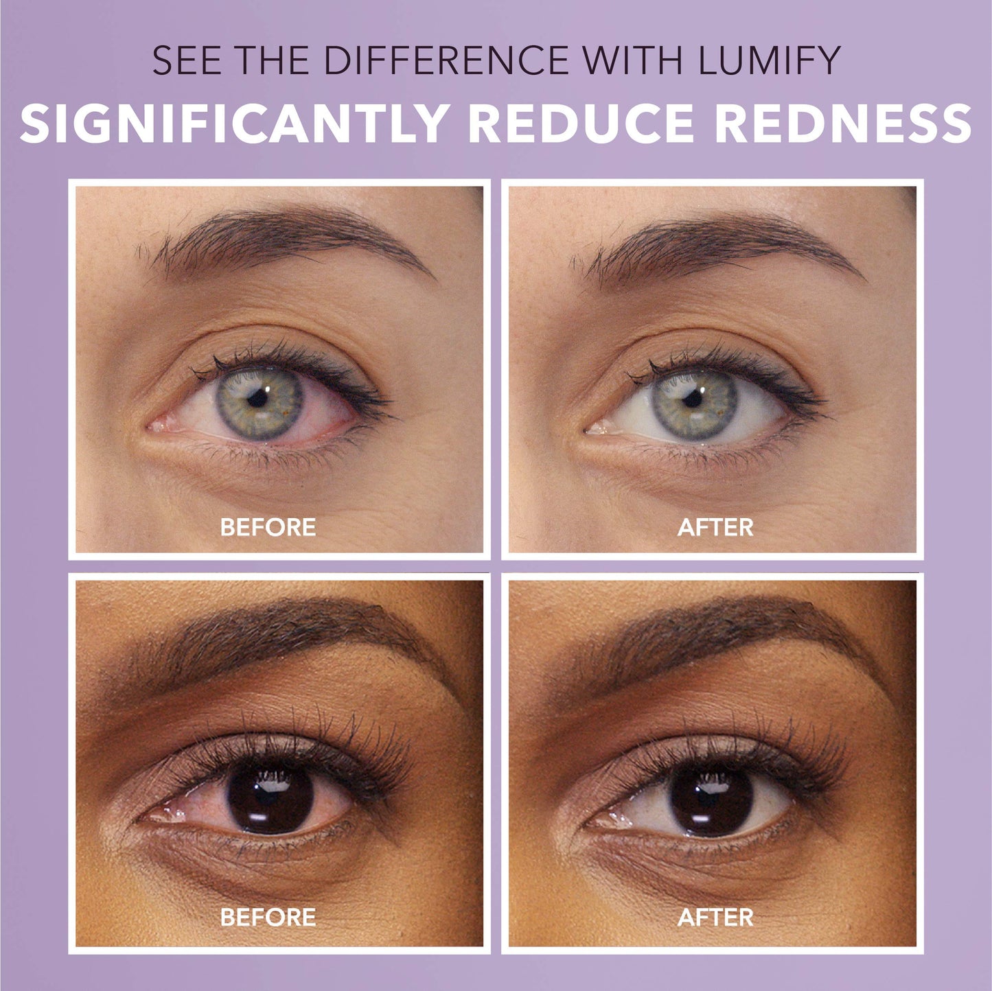LUMIFY Gotas para los ojos para aliviar el enrojecimiento 7.5 ml